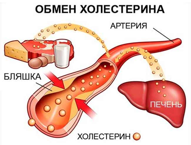 Échange de cholestérol