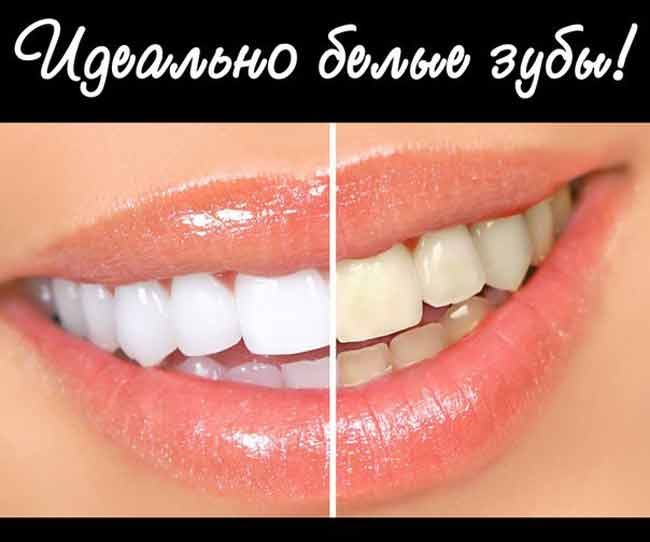 How to whiten your teeth