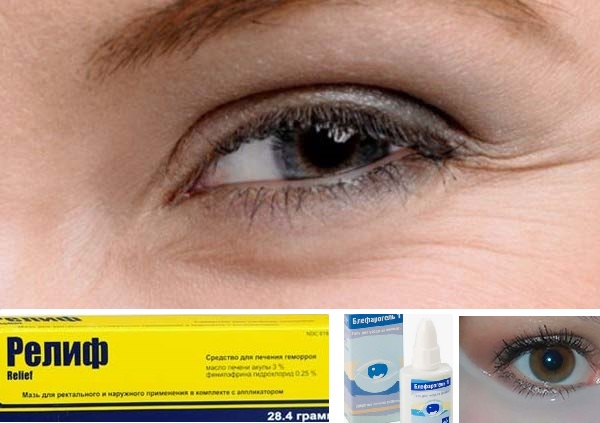 Anti wrinkles under the eyes - prevention and treatment