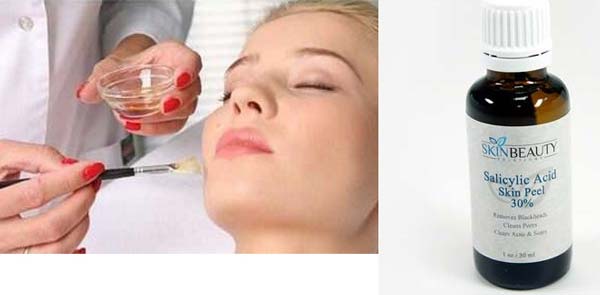 Salicylic peeling 30%