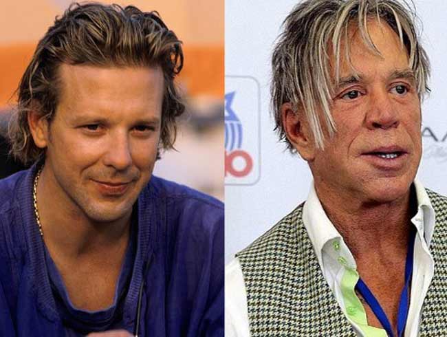 Mickey Rourke