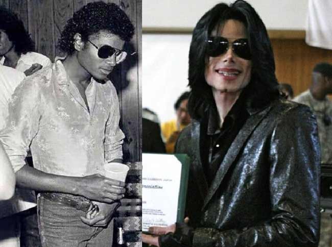 Michael Jackson avant et après la chirurgie esthétique