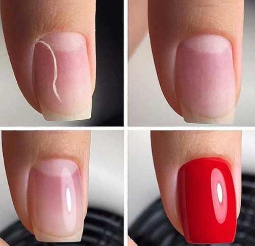 Gel nail extension problems