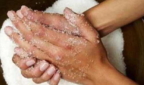 Taches pigmentées sur les mains, que faire