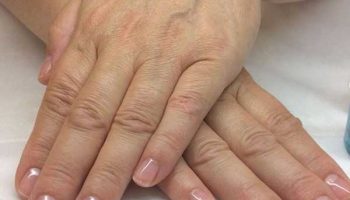 Hand baths against dryness and age spots