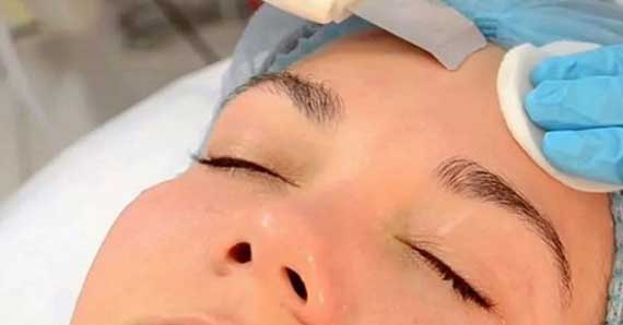 Comment nettoyer les pores du visage de manière